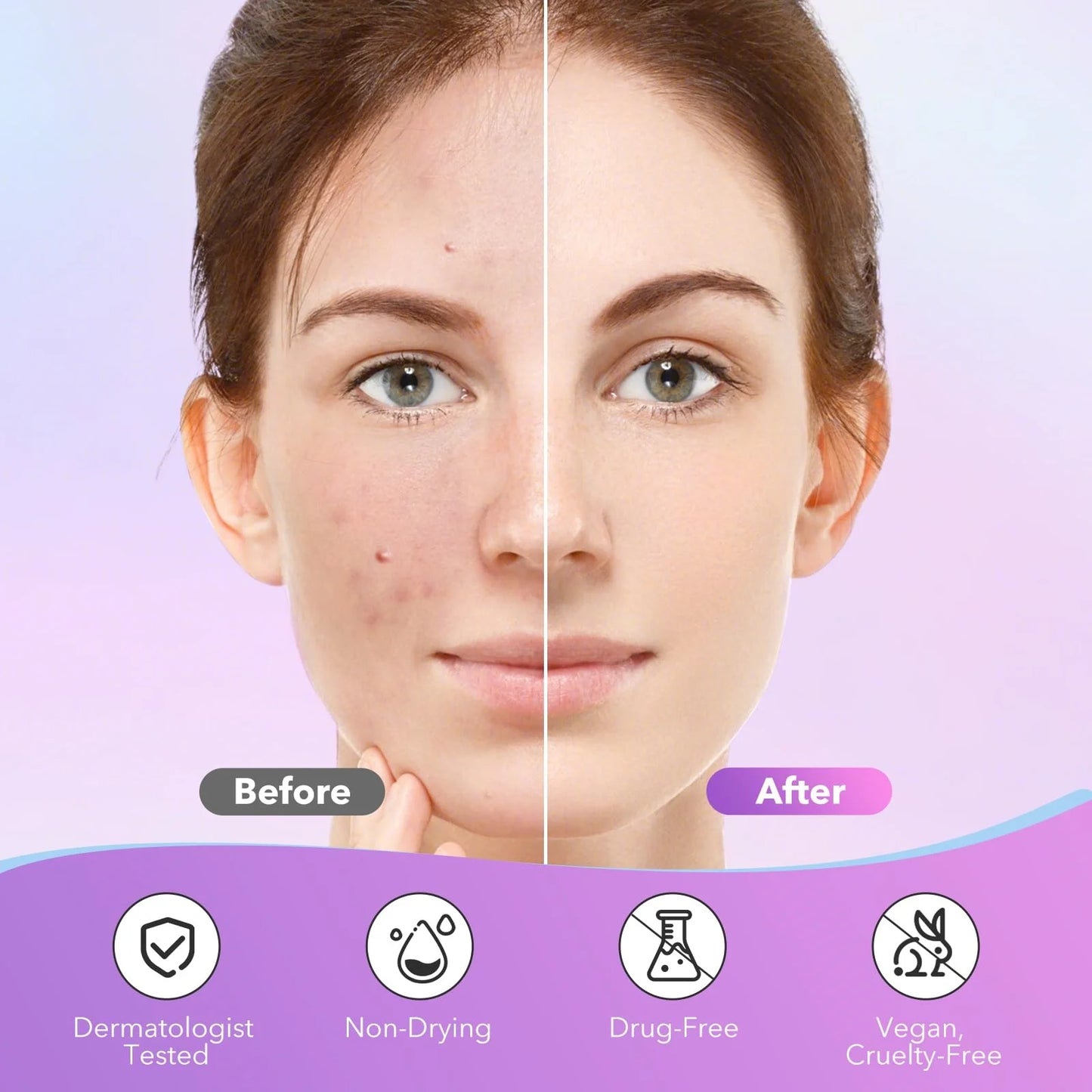 1680 Pimple Patch - Gentle and Non-Irritating, Covers Acne and Blemishes -